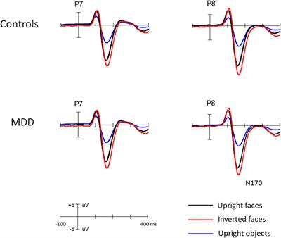 The effect of age on the early stage of face perception in depressed patients: An ERP study